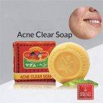 ⁦صابون عشبي لعلاج حب الشباب Madame Heng Acne Clear Soap⁩ - الصورة ⁦3⁩