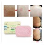 ⁦صابون لعلاج الصدفية ومشاكل الجلد Zudaifu Sulfur Soap⁩ - الصورة ⁦5⁩