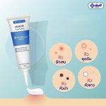 ⁦Yanhee Acne Cream 10 gr⁩ - الصورة ⁦4⁩