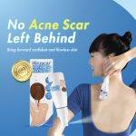 ⁦Hiruscar Post Acne Back Spray⁩ - الصورة ⁦3⁩