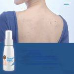 ⁦Hiruscar Post Acne Back Spray⁩ - الصورة ⁦2⁩