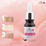 ⁦سيروم مضاد للتصبغات مع الأربوتين Diana + Triple Arbutin⁩ - الصورة ⁦5⁩