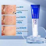 ⁦Pair Acne Cream 24 gr⁩ - الصورة ⁦5⁩