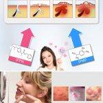 ⁦Pair Acne Cream 24 gr⁩ - الصورة ⁦2⁩