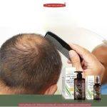 ⁦Carebeau Long & Anti Hair Loss Shampoo⁩ - الصورة ⁦3⁩