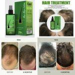 ⁦HC-GW Neo Hair Lotion⁩ - الصورة ⁦6⁩