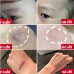 ⁦100% Dermatix Ultra Gel 15 g⁩ - الصورة ⁦3⁩