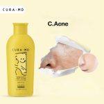 ⁦CURA-MD Prebiotic Anti-Acne Cleansing Gel 100 ml⁩ - الصورة ⁦2⁩