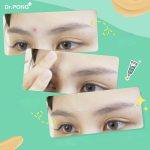 ⁦Dr.PONG 101 Acne Clear Concealer 2 in 1⁩ - الصورة ⁦2⁩