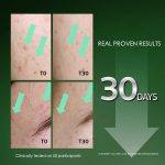 ⁦Plantnery Tea Tree Acne Microbiome Intense Serum 30 ml⁩ - الصورة ⁦5⁩