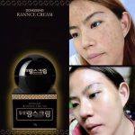 ⁦Dong sung Rannce Cream 10 g⁩ - الصورة ⁦3⁩