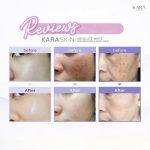 ⁦KARA Skin Absolute White Serum 30 ml⁩ - الصورة ⁦3⁩