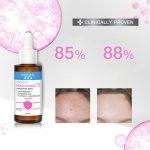 ⁦MizuMi Advance Niacinamide 15 Concentrate Serum 30 ml⁩ - الصورة ⁦3⁩