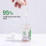 ⁦Oxe Cure Acne Clear Potion 15 ml⁩ - الصورة ⁦3⁩