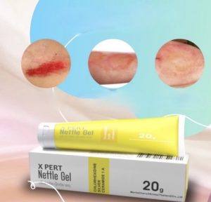 ⁦X Pert Nettle Gel 20 g⁩ - الصورة ⁦3⁩