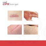 ⁦Dr.PONG CPX Scar gel 10 g⁩ - الصورة ⁦2⁩