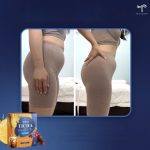 ⁦TTM TICHA Mix Fruit Tea Probiotic Weight loss 10 Sachets⁩ - الصورة ⁦3⁩