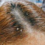 ⁦Shampoing aux herbes pour le psoriasis et les pellicules Zudaifu Shampoo 120 ml⁩ - الصورة ⁦2⁩