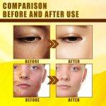 ⁦Yellow Peeling Oil 30 ml⁩ - الصورة ⁦3⁩