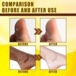 ⁦Yellow Peeling Oil 30 ml⁩ - الصورة ⁦2⁩