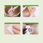 ⁦ALIVER Corn Removal Plaster 24 pcs⁩ - الصورة ⁦2⁩