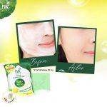 ⁦BK Acne Natural Whipped Soap⁩ - الصورة ⁦3⁩