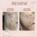 ⁦Nerista Cleansing Gel + Nerista Soap⁩ - الصورة ⁦2⁩