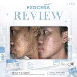 ⁦Jose Exocera Booster Ampoule 15 ml⁩ - الصورة ⁦3⁩